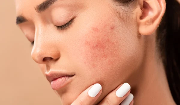 Dấu Hiệu Cho Thấy Làn Da Đang Kêu Cứu